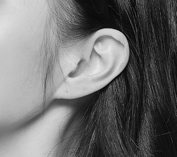 귀 연골 위치를 표시한 귀 이미지