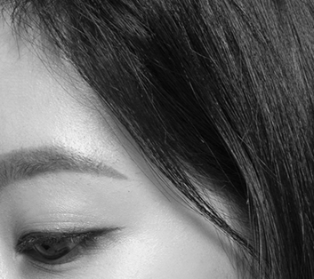 코성형에 사용하는 근막 채취 부위를 표시한 이미지