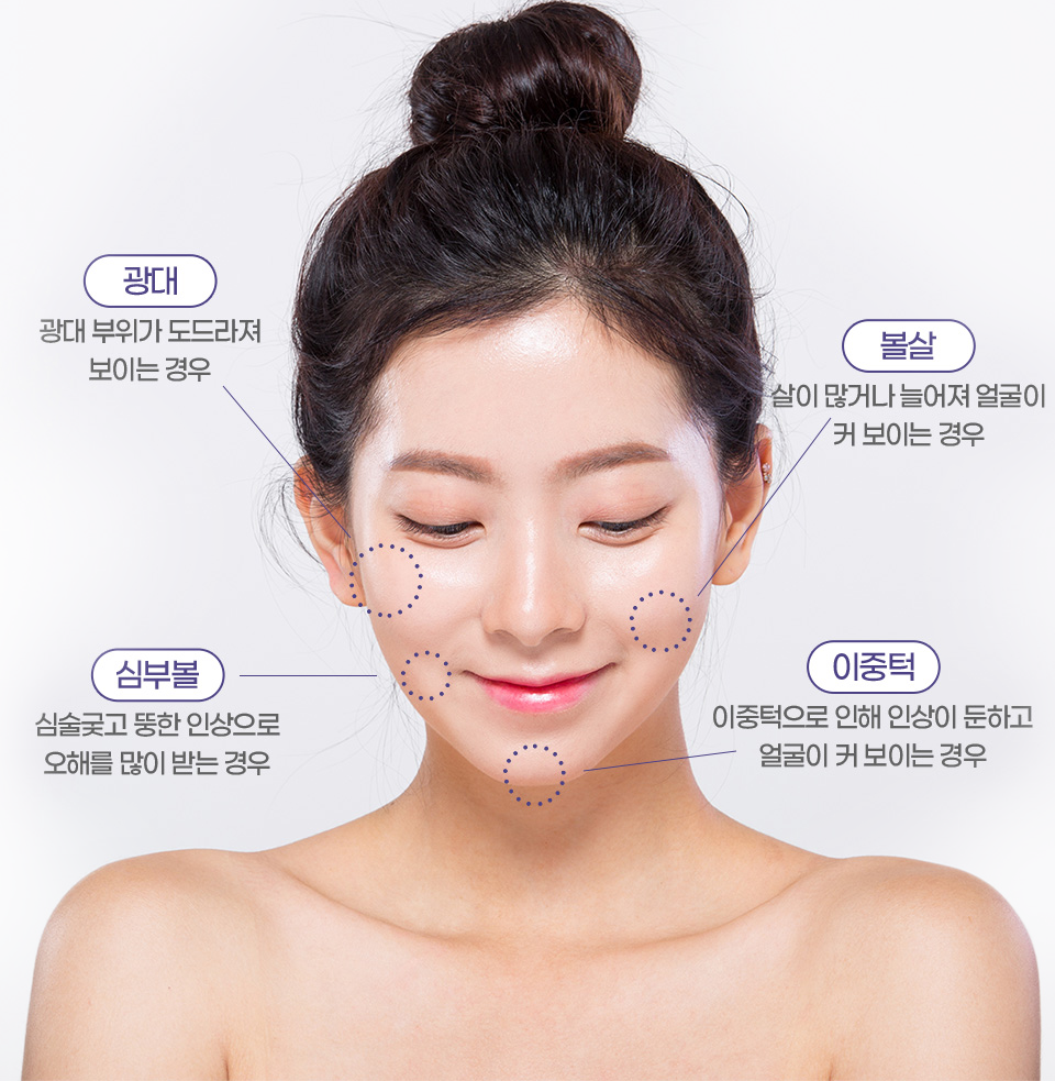 윤곽조각술 시술 부위 안내