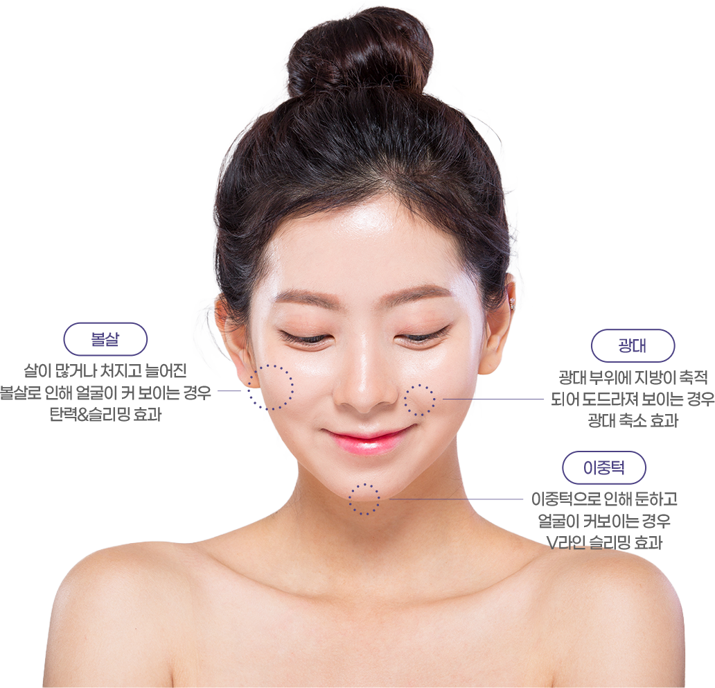 V락주사 시술 부위 안내