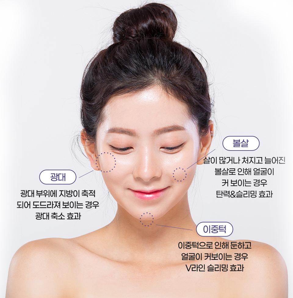 V락주사 시술 부위 안내
