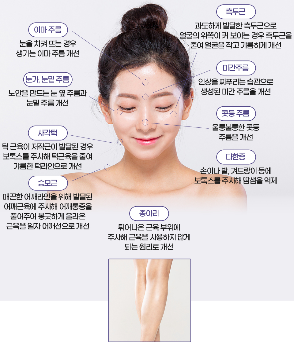 보톡스 얼굴 및 승모근 시술 부위 안내