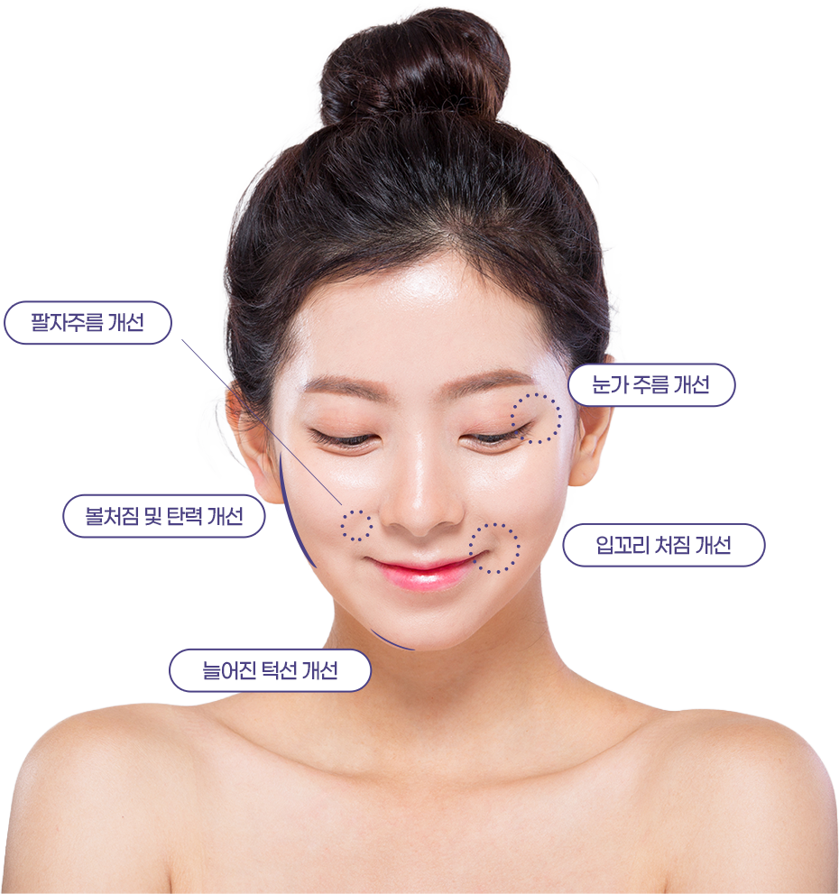 미니거상술의 시술 부위 안내