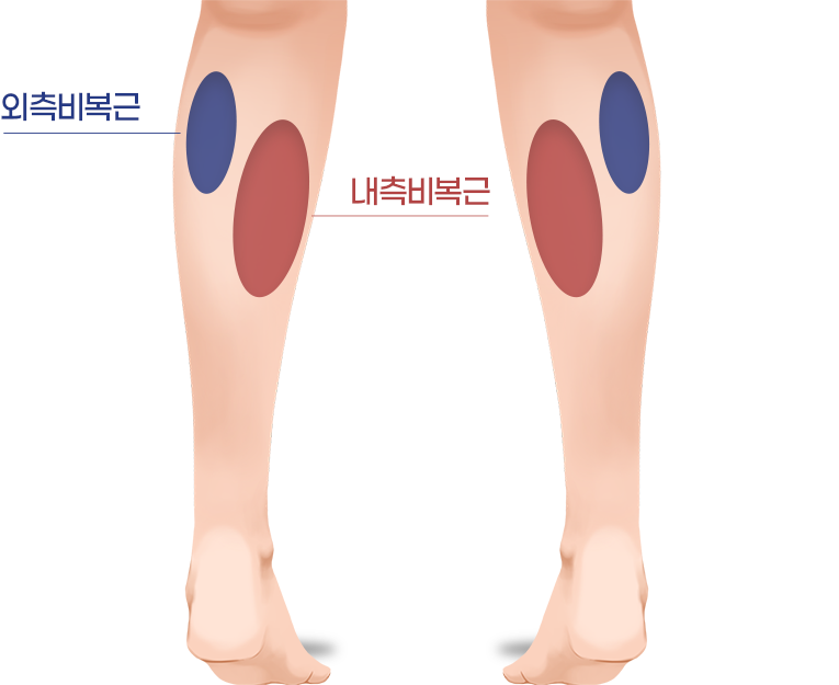 외측비복근과 내측비복근 위치 안내